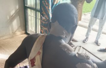 Two Die, Many Injured as Bandits Launch Attacks Along Igbeti–Kisi Road