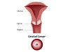 Nigeria Records 12,000 Cervical Cancer Cases, 8,000 Deaths Yearly Cervical Cancer